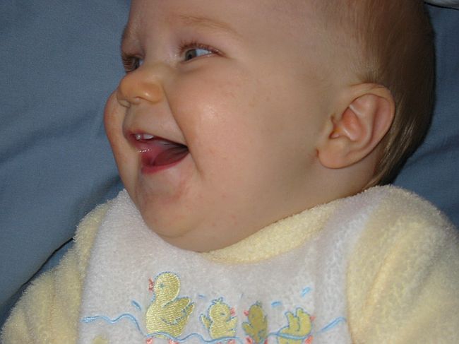 Click on image for details