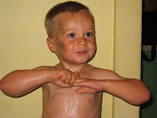 Click on image for details