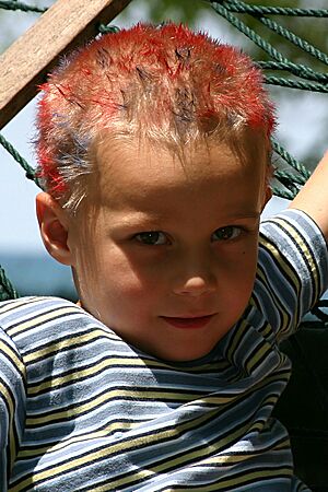 Click on image for details